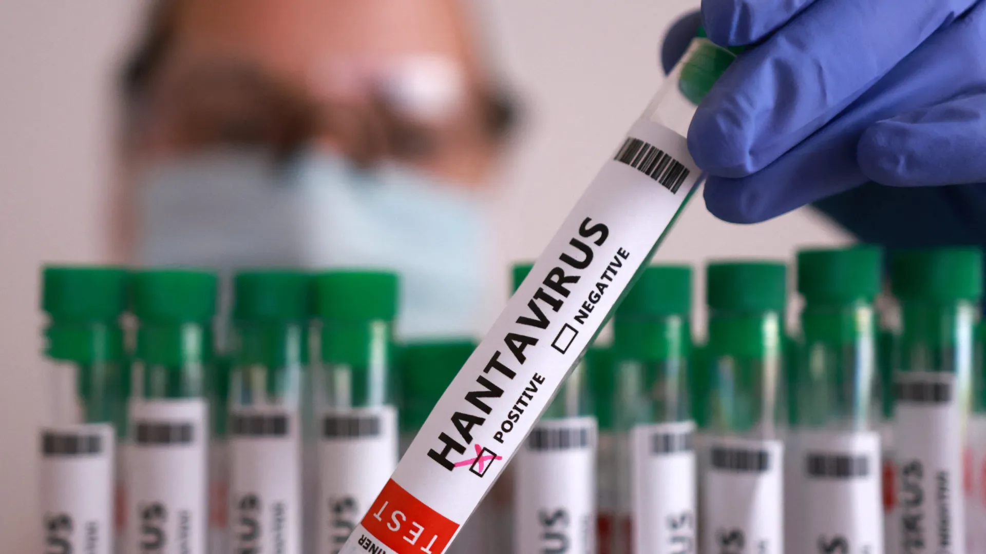 Evacuated Cruise Passengers Test Positive For Hantavirus