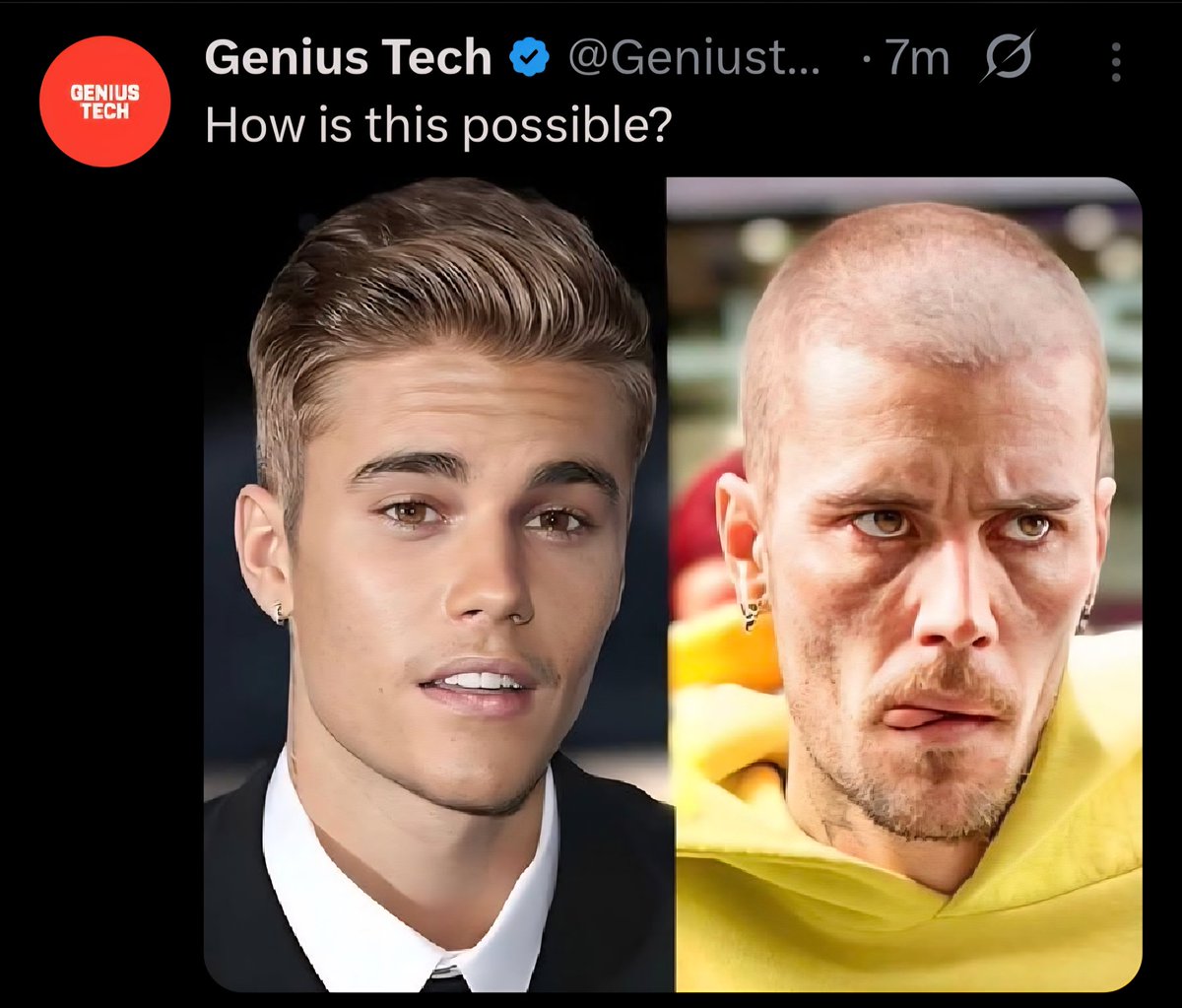 Justin Bieber